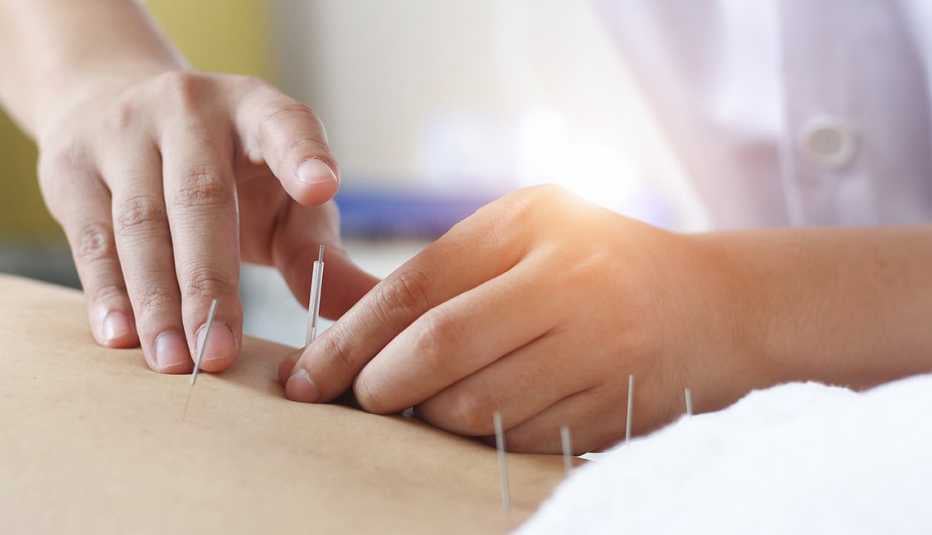 Acupuncture for low back pain in Bridgewater