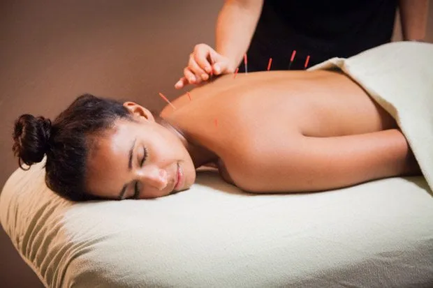 A patient receiving acupuncture treatment on her back