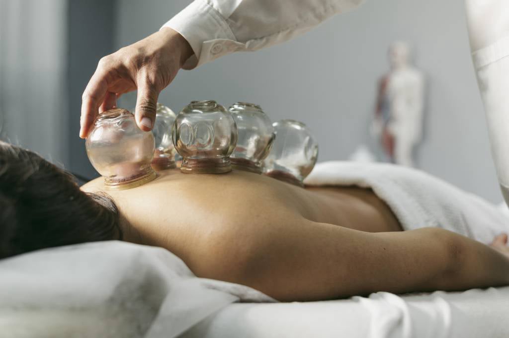 Cupping Therapy at PremierMD Bridgewater and Nutley