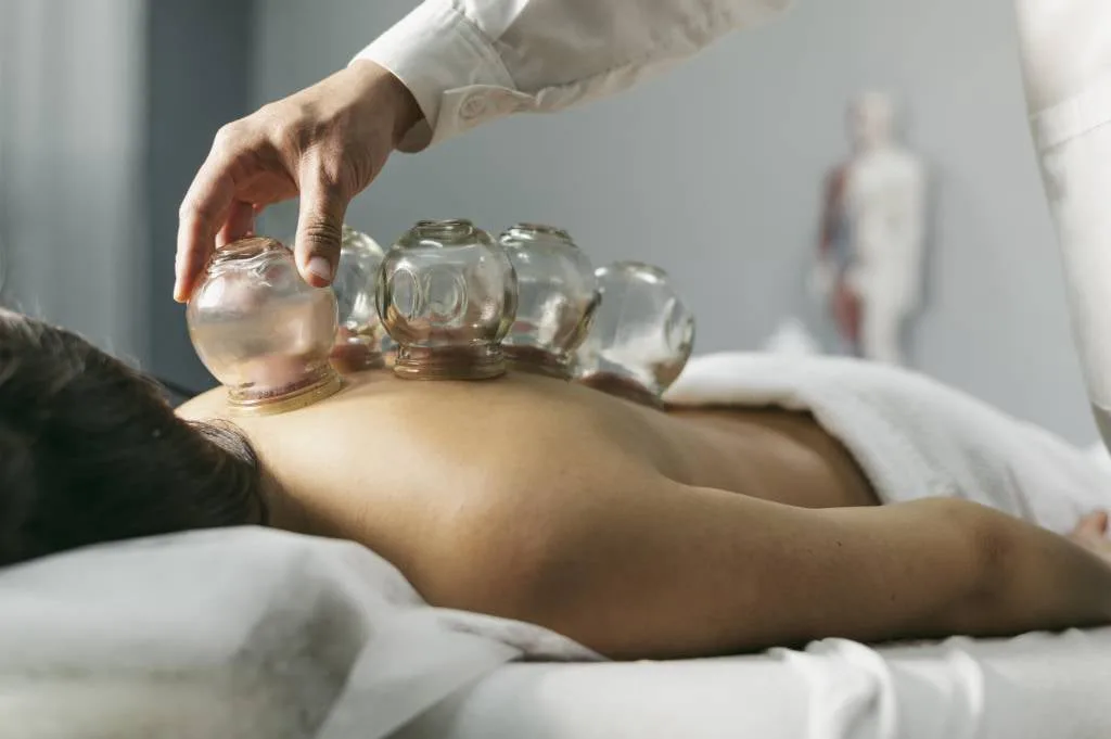 Suction cups being applied to a patient's back during a cupping therapy session
