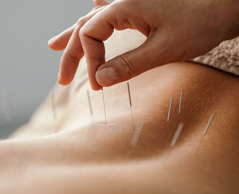 Medical acupuncture for women's health at PremierMD