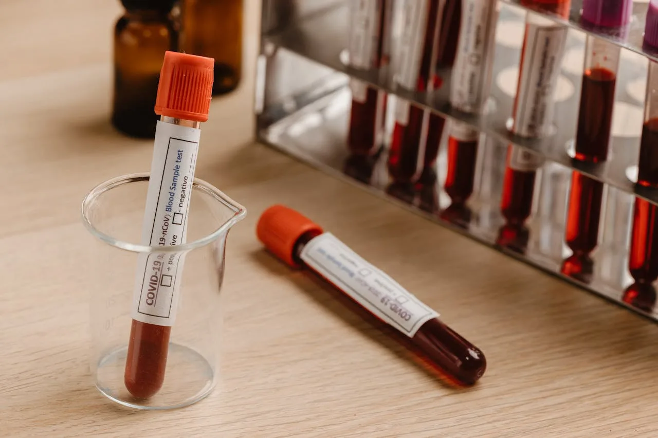 A PSA blood test consultation at MyPremierMD